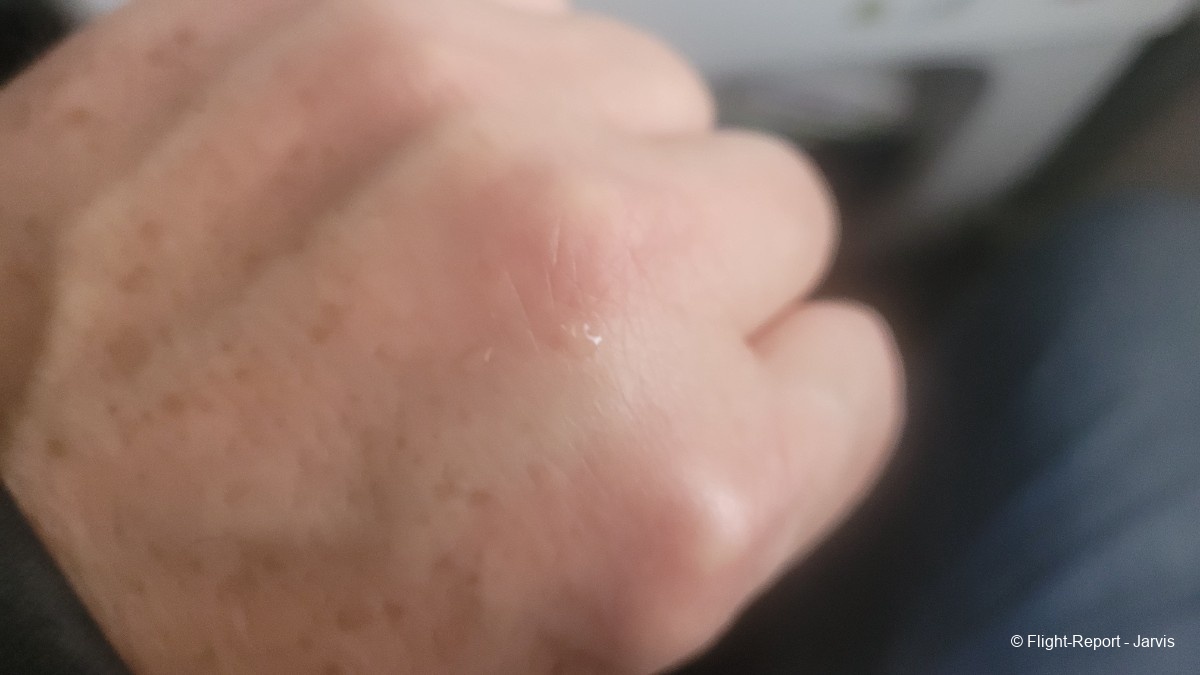 photo 20260316_090828